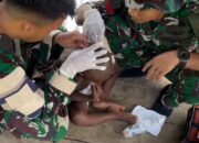 Pos Selal Satgas Yonif 751/VJS Tangani Cacar/Bisul pada Anak: Pengobatan Gratis & Edukasi Kebersihan Lingkungan