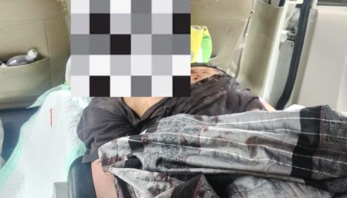 Dua Pemuda Terluka Akibat Ledakan Petasan di Mangunjaya, Polisi Datangi TKP