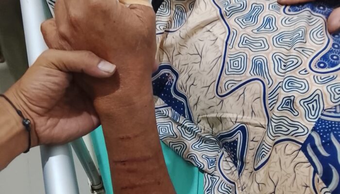 Respons Cepat Polda Sumsel: Polres OKU Beri Pertolongan Medis bagi Korban Serangan Beruang